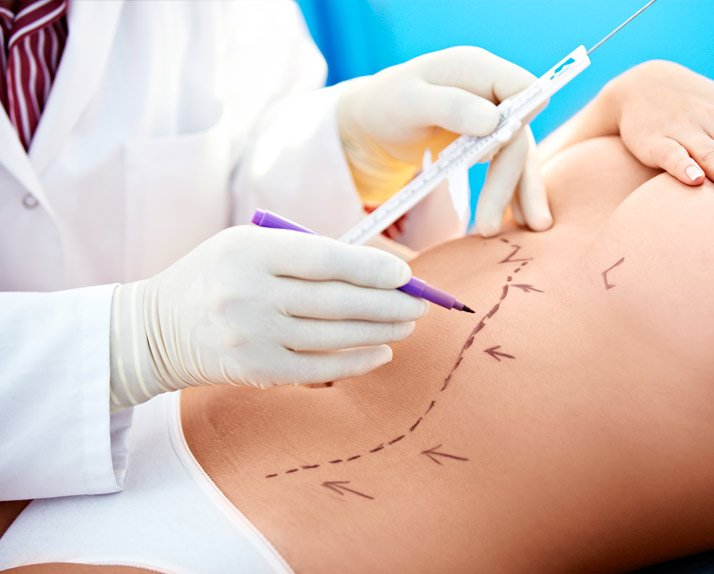 Cirurgia Plástica em São José dos Campos